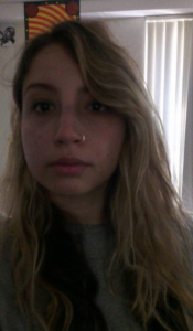 The next morning aftermath, check out the bruise